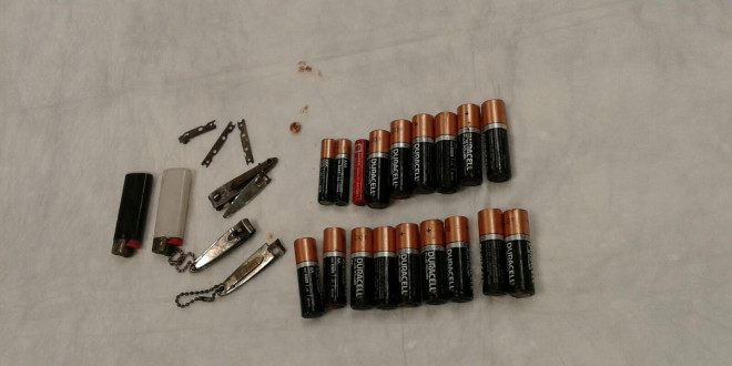 Perugia, equipe di medici estrae 27 oggetti dallo stomaco di un giovane detenuto: è record